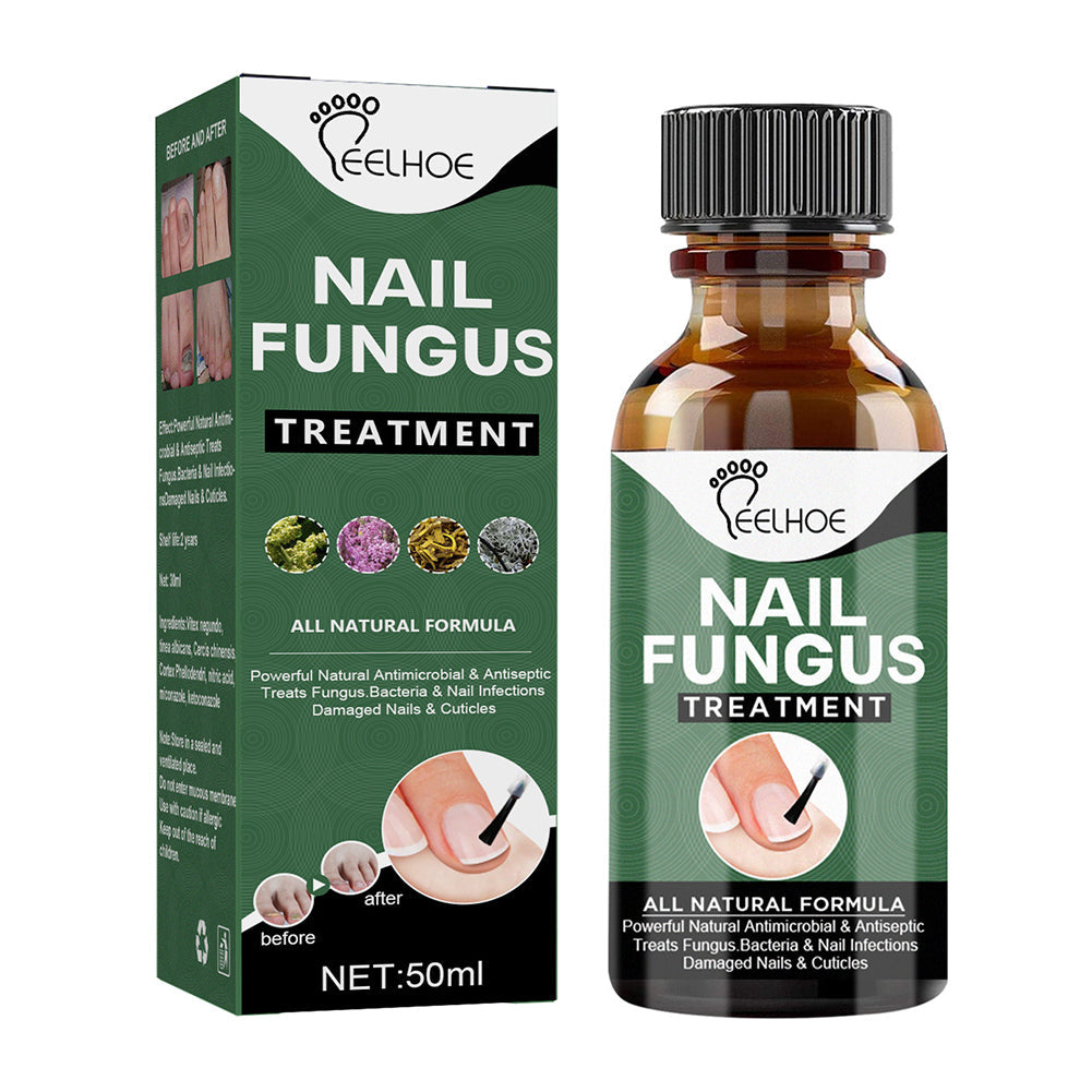 Nail Fungus Serum bottle for fungal nail treatment in Pakistan