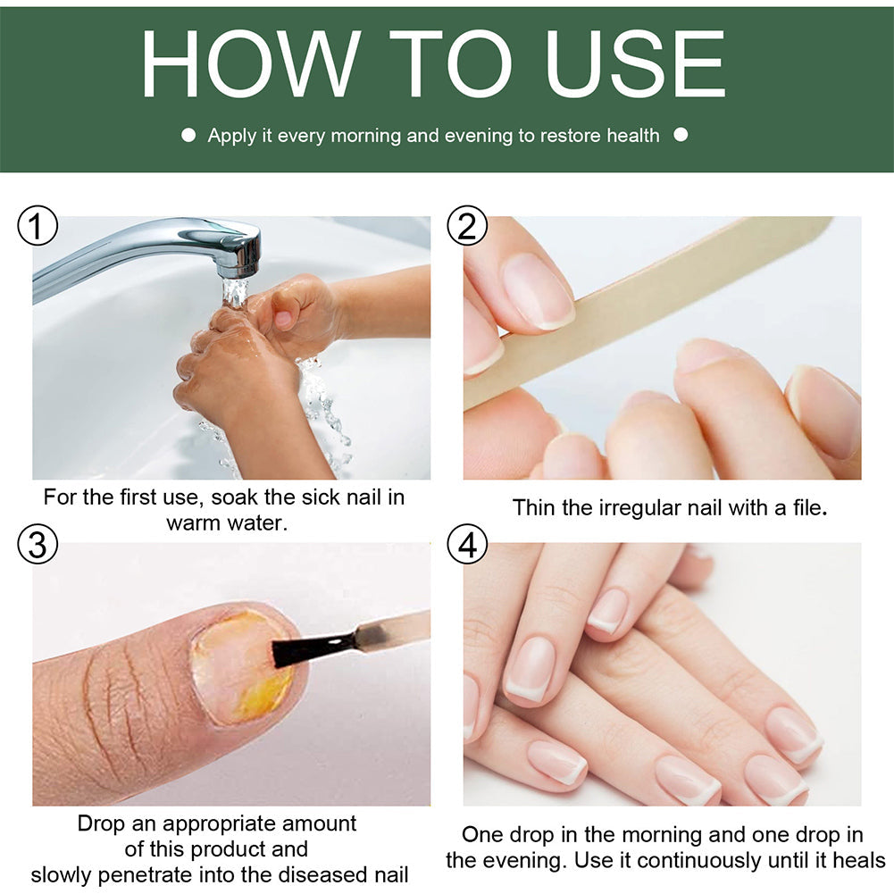 Natural nail fungus treatment oil for hands and feet