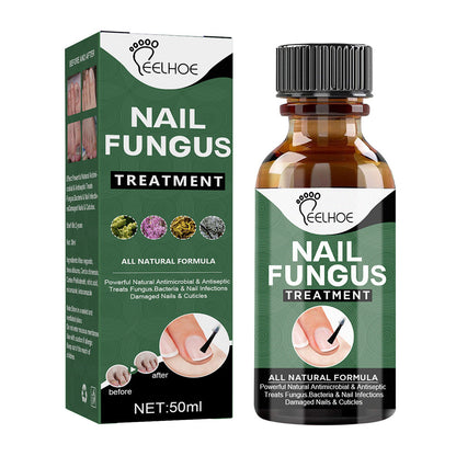 Nail Fungus Serum bottle for fungal nail treatment in Pakistan